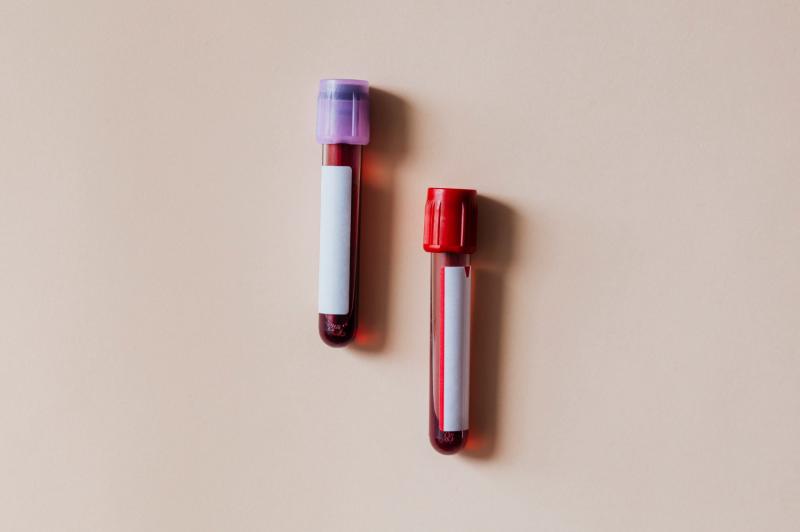 O Poder do Bionova: Indicador Biológico para Esterilização
