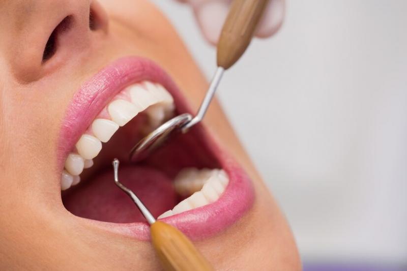 Seladora Odontológica: O Que Você Precisa Saber